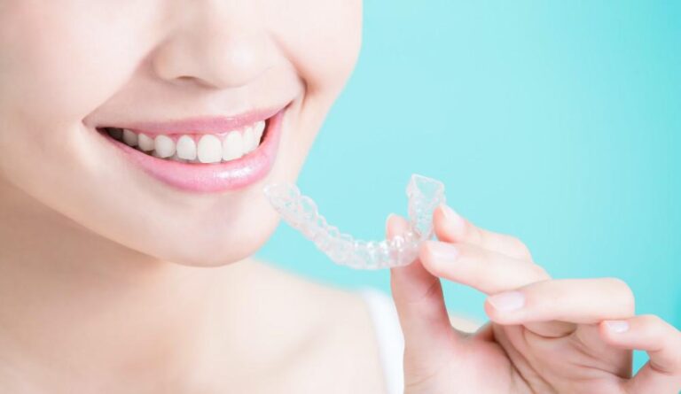 4 Amazing Benefits Of Getting Invisalign