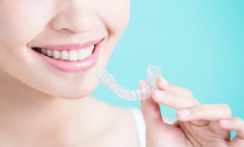 4 Amazing Benefits Of Getting Invisalign