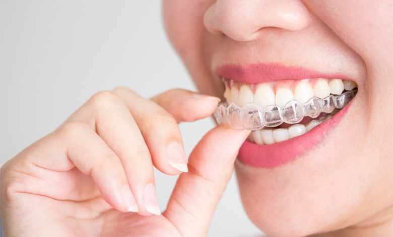 All You Need To Know About Invisalign And Braces