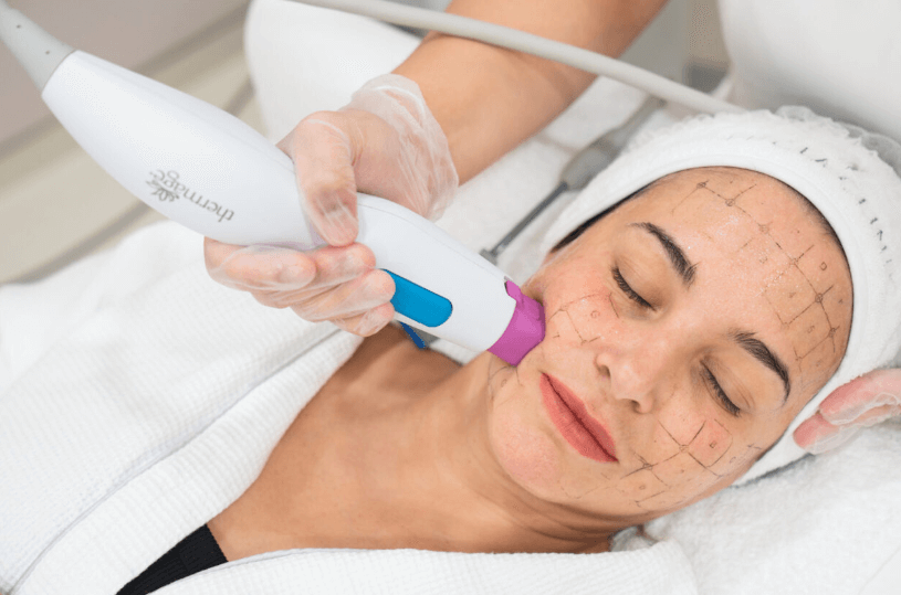 The Dubai Definition of Radiance: A Manual to Laser Skin Tightening